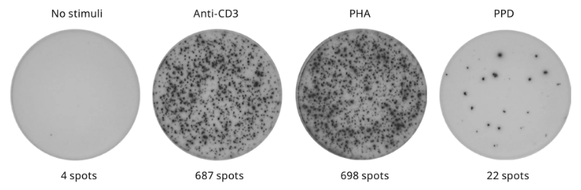 ELISpot检测小贴士之细胞样本准备