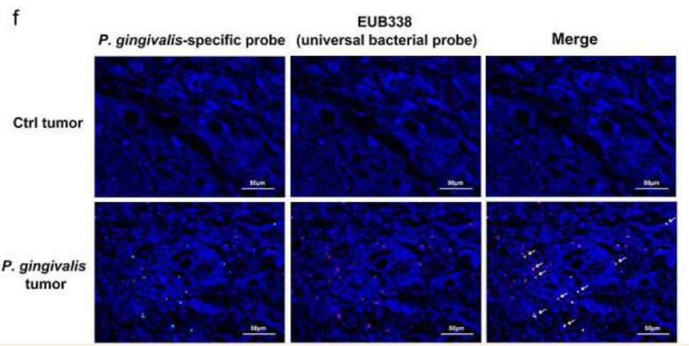 直接荧光标记细菌 FISH探针总结