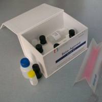 结核分歧/杆菌荧光PCR检测试剂盒