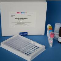 禽流感病毒通用型荧光RT-PCR检测试剂盒