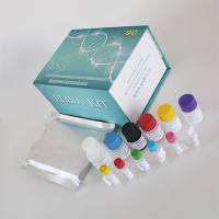 微生物（Microorganism）烟酰胺腺嘌呤二核苷酸（NADH）  ELISA检测试剂盒