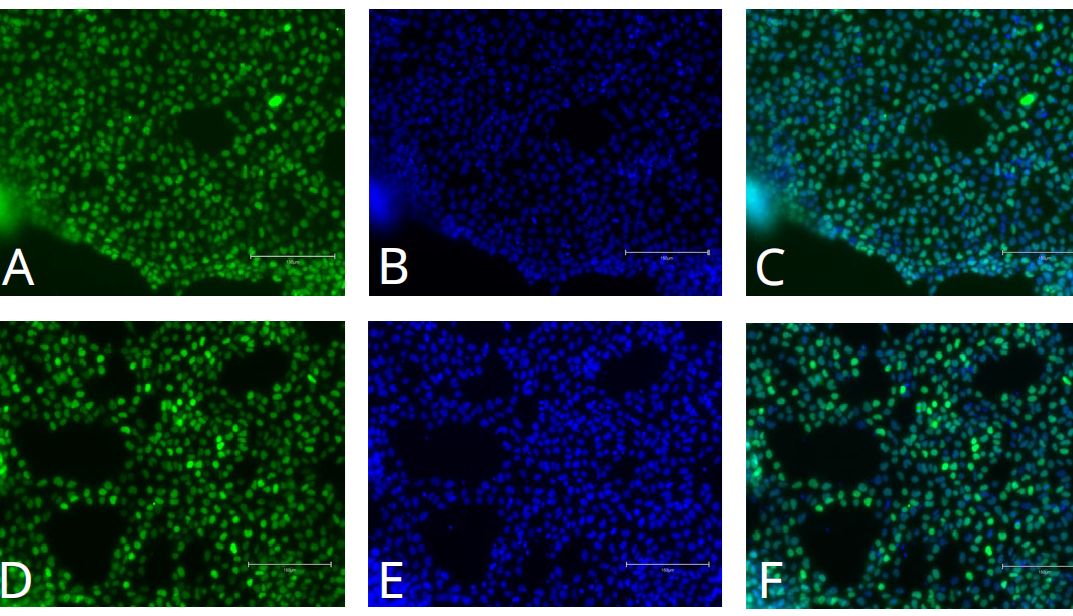 Qkine细胞因子：iPSC向三胚层分化系列--中胚层_曼博生物代理