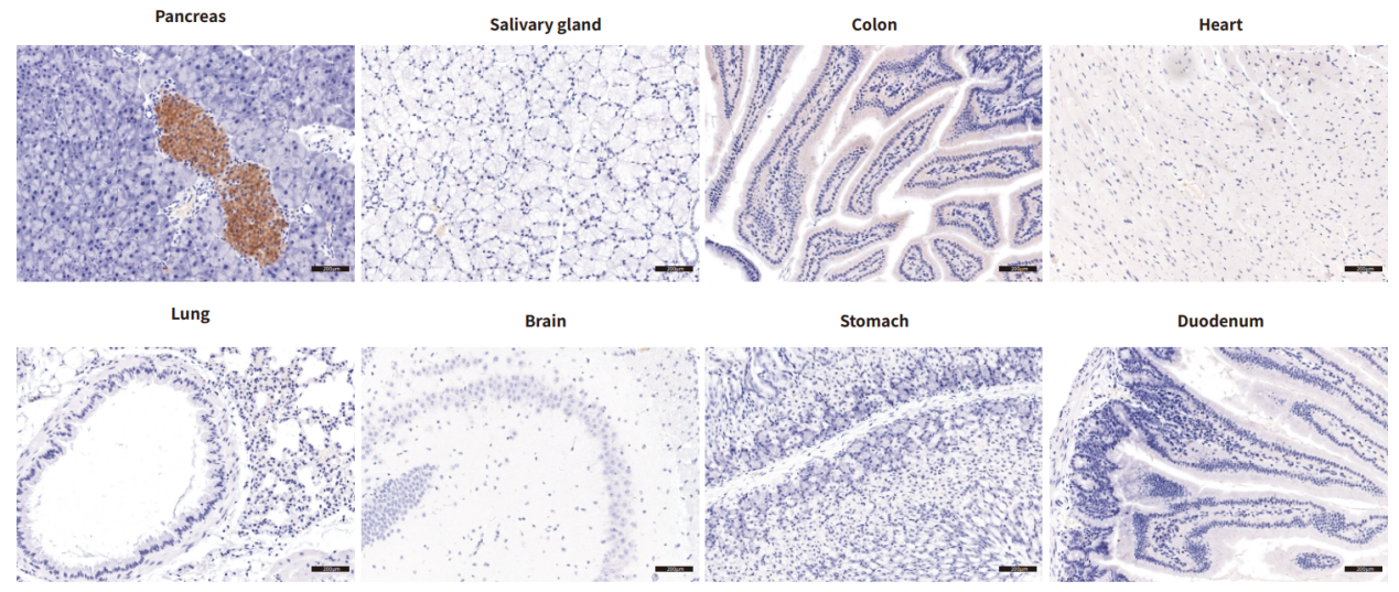 国际糖尿病日，这些糖尿病动物模型有大用！