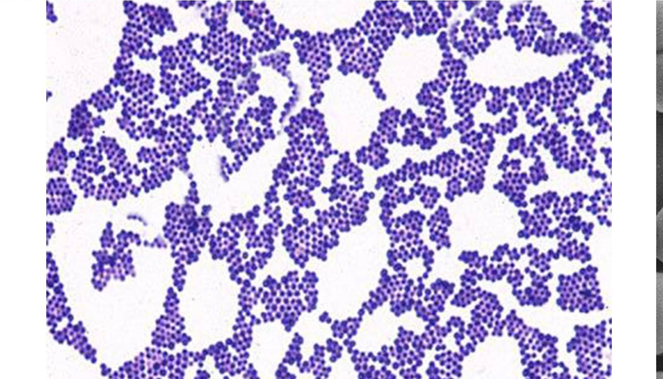 葡萄球菌属丨金黄色-葡萄球菌简介