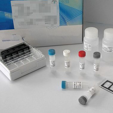 禽流感病毒H5/H7亚型双重荧光RT-PCR检测试剂盒