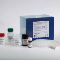 炭疽杆菌rpoB基因荧光PCR检测试剂盒