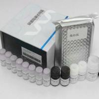 非洲猪瘟病毒荧光PCR核酸检测试剂盒