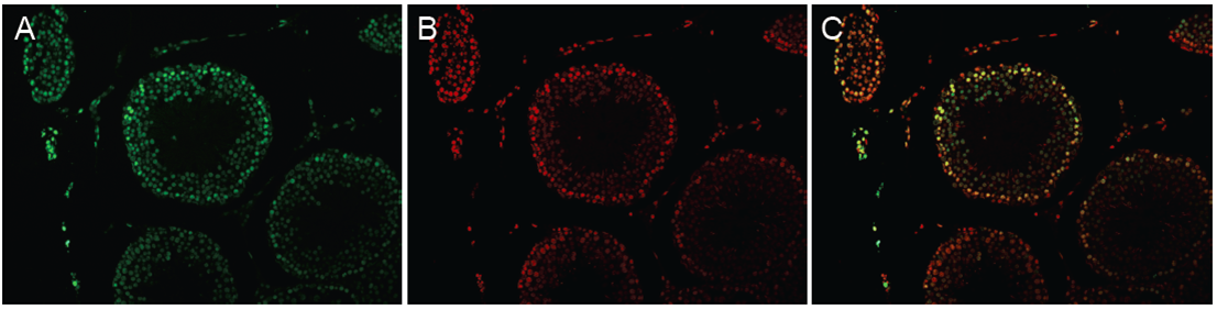 TUNEL FITC Apoptosis Detection