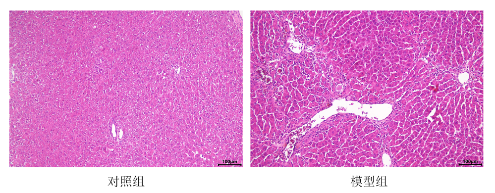 肝损伤模型