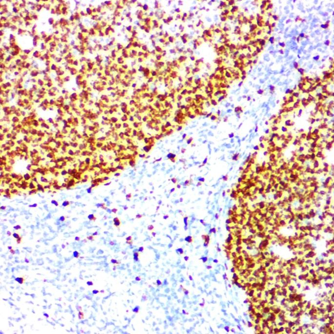 双增强型HRP标记羊抗小鼠/兔聚合物二抗