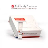 Anti-霍乱 LPS/Lipopolysaccharide Antibody (SAA0582)