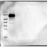 新城疫F蛋白(哺乳动物细胞)