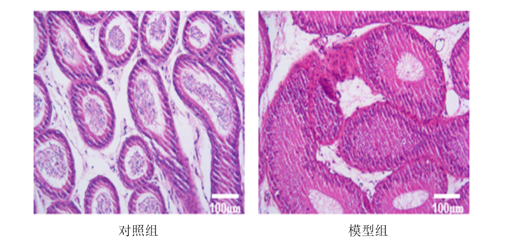 肥胖症模型（高脂饲料诱导）