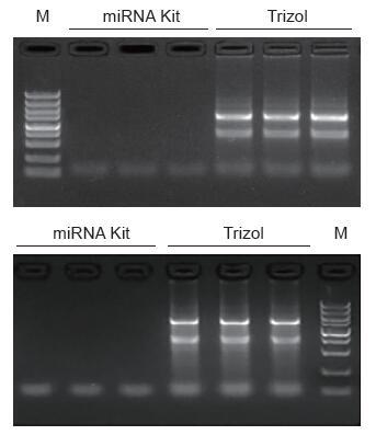 细胞/组织miRNA提取试剂盒 MiPure Cell/Ti