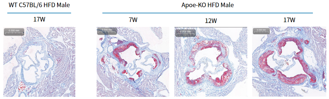 疾病模型 | 动脉粥样硬化小鼠模型(内含福利)