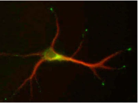 NeuroMab-抗SCG10/Stathmin-2抗体正在促销