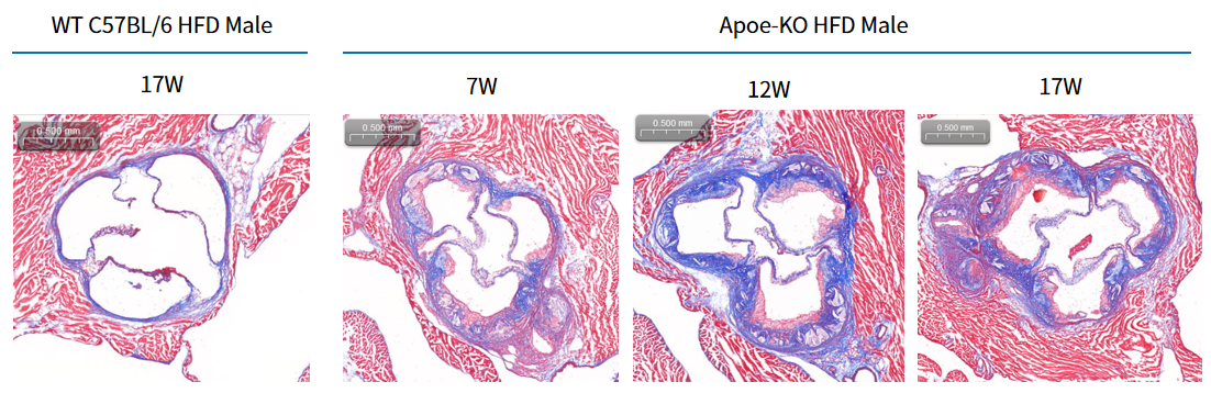 疾病模型 | 动脉粥样硬化小鼠模型(内含福利)