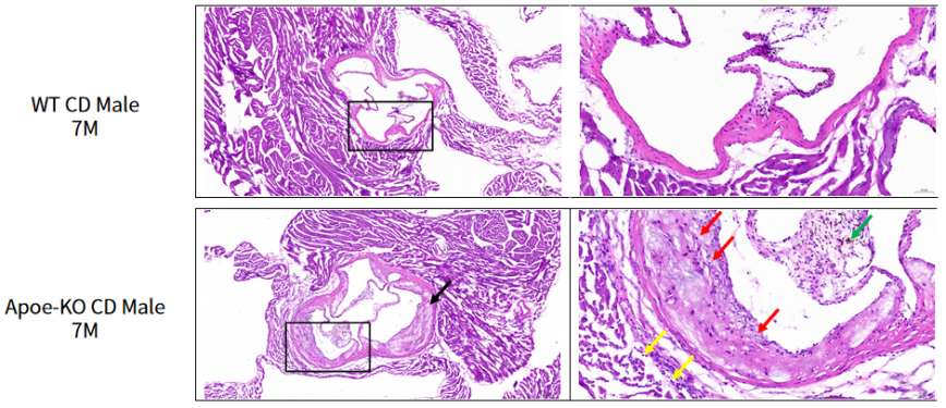 疾病模型 | 动脉粥样硬化小鼠模型(内含福利)