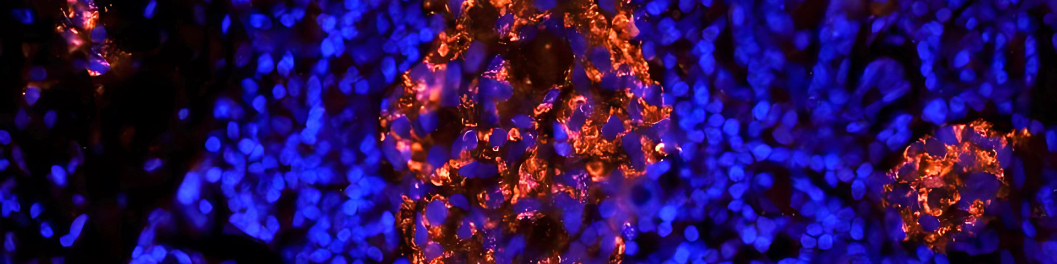 【Biorbyt实验】免疫组织化学（IHC）和免疫细胞化学 （ICC）在癌症研究中的应用