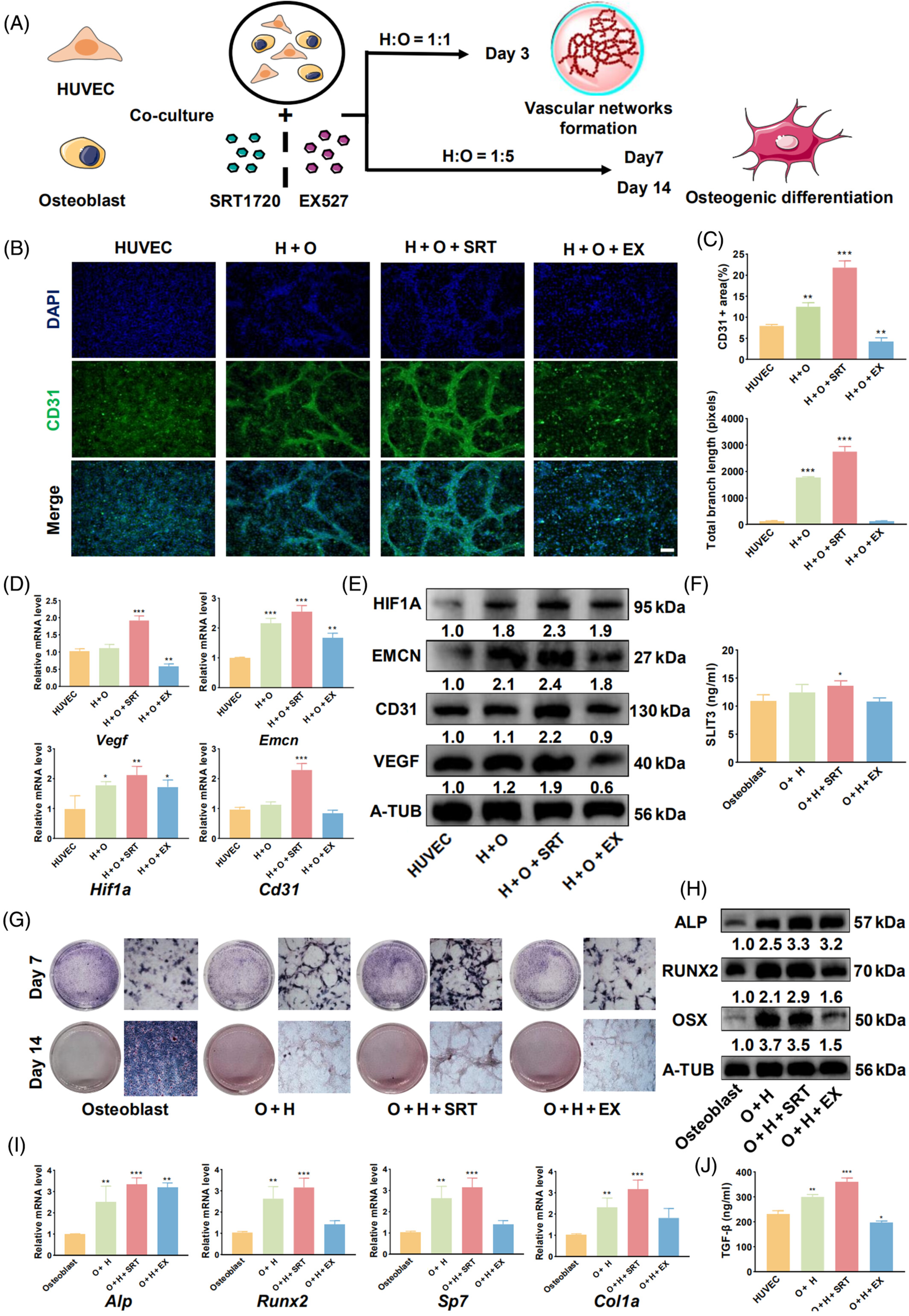 激活的SIRT1 通过增强 H 型血管生成和骨形成的耦联来促进骨修复