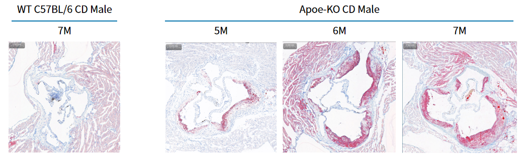疾病模型 | 动脉粥样硬化小鼠模型(内含福利)