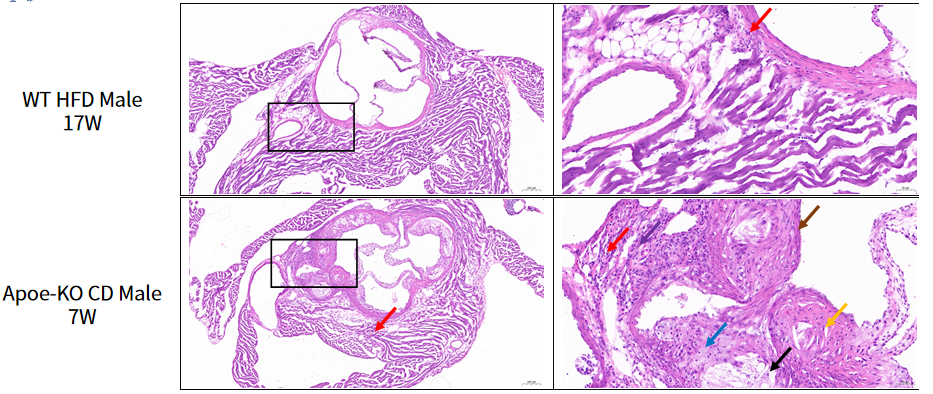 疾病模型 | 动脉粥样硬化小鼠模型(内含福利)