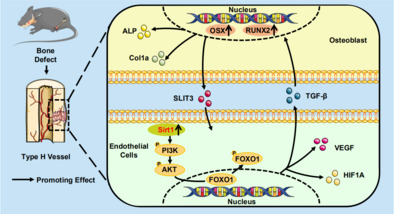 激活的SIRT1 通过增强 H 型血管生成和骨形成的耦联来促进骨修复