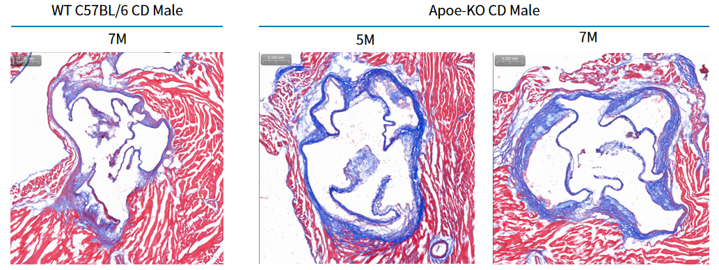 疾病模型 | 动脉粥样硬化小鼠模型(内含福利)