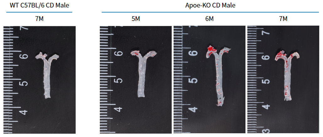 疾病模型 | 动脉粥样硬化小鼠模型(内含福利)
