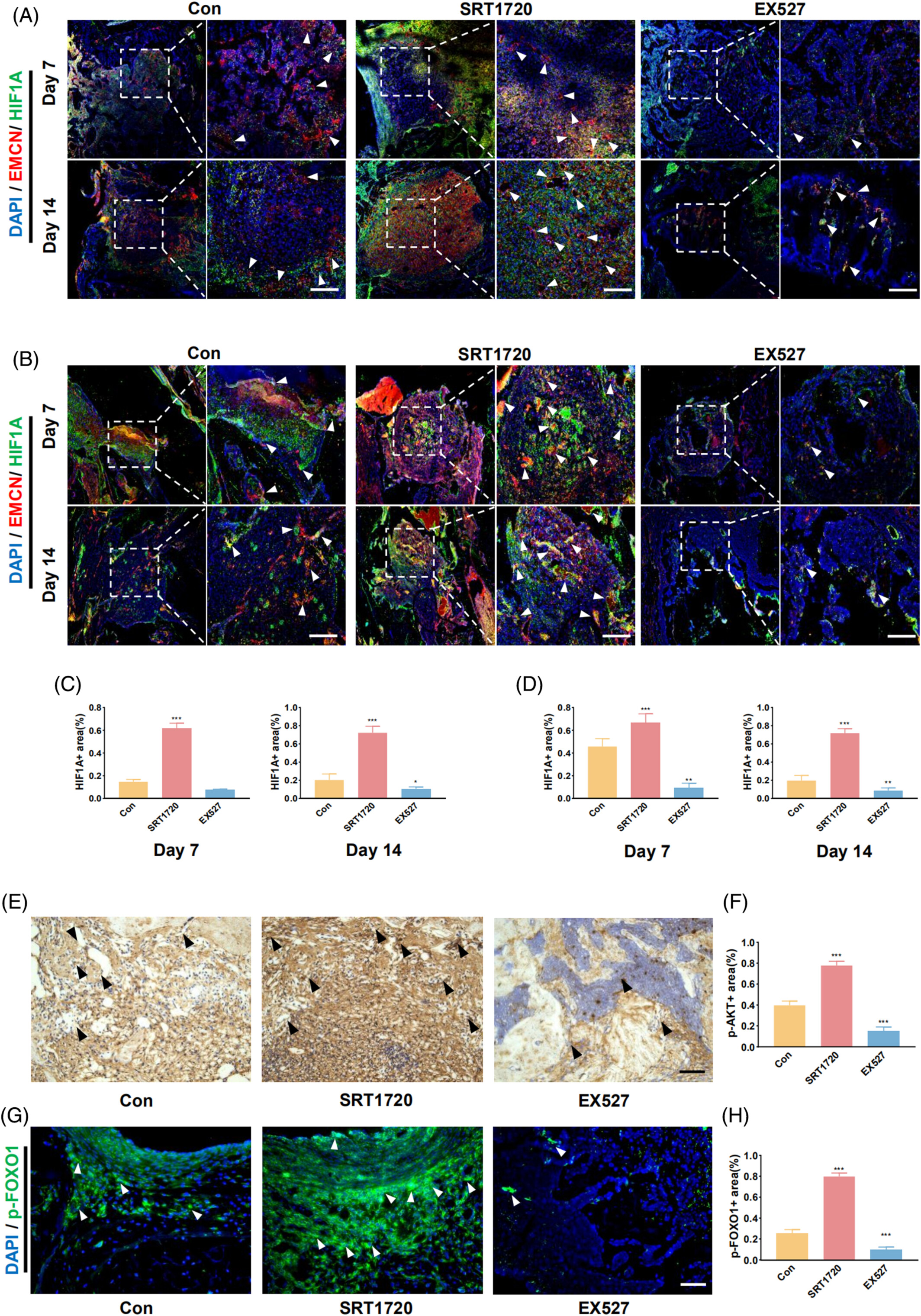 激活的SIRT1 通过增强 H 型血管生成和骨形成的耦联来促进骨修复