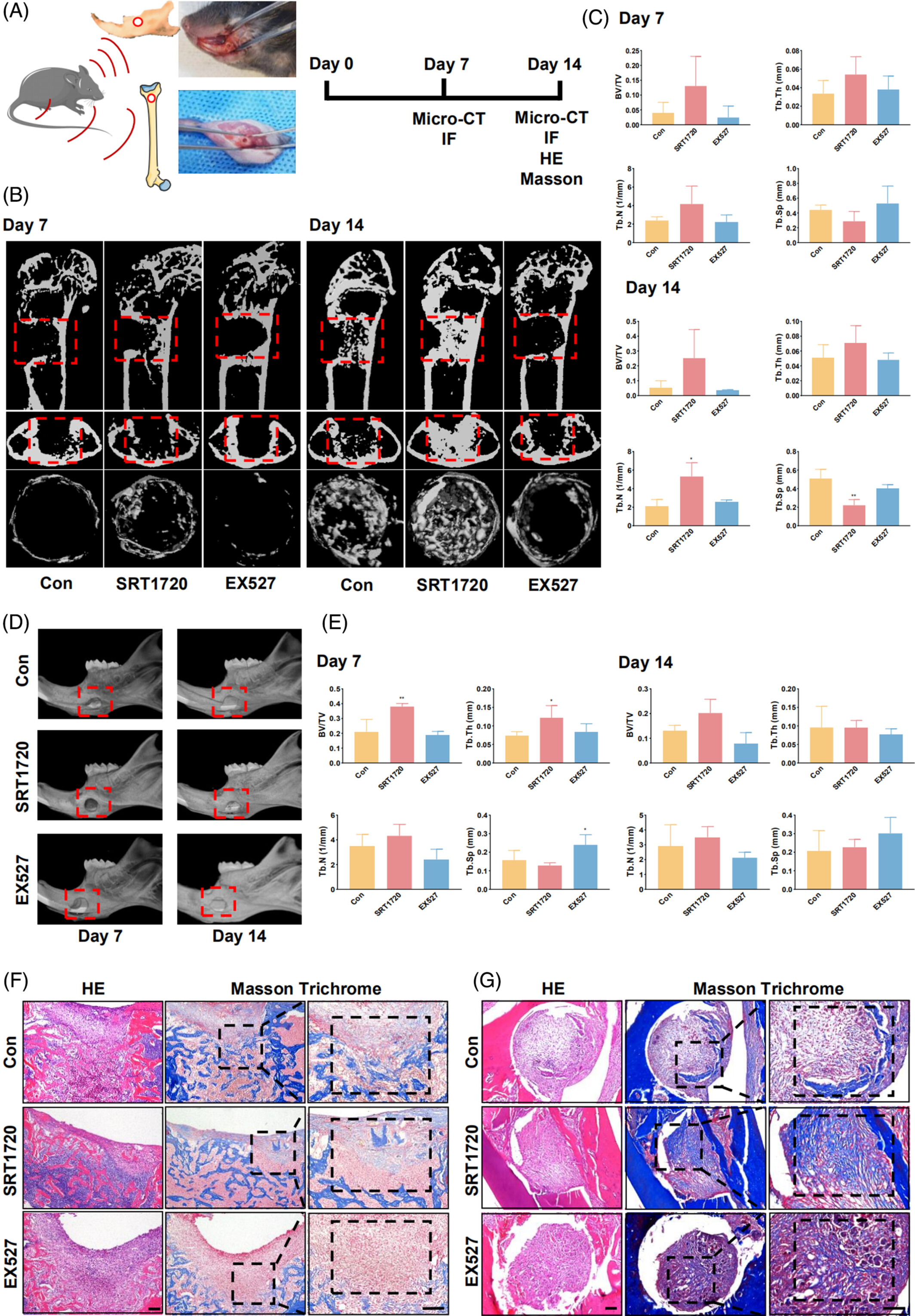 激活的SIRT1 通过增强 H 型血管生成和骨形成的耦联来促进骨修复
