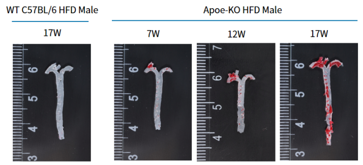 疾病模型 | 动脉粥样硬化小鼠模型(内含福利)