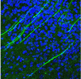 NeuroMab-研究级纯化抗CV1.3钙通道抗体促销中