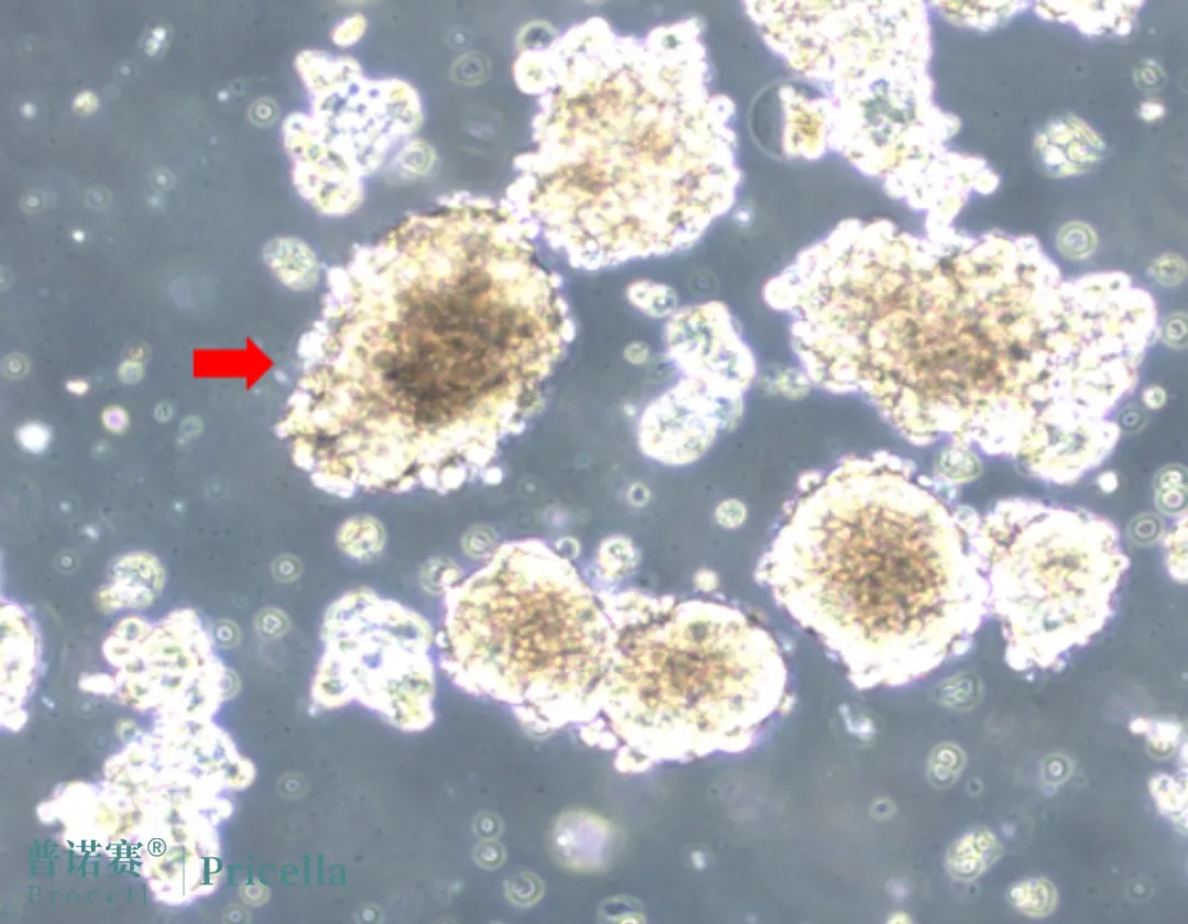 细胞学堂 | 细胞又双叒叕聚团了？解决攻略来了！