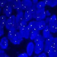 辰辉创聚生物®Nebulabio- FISH探针系列