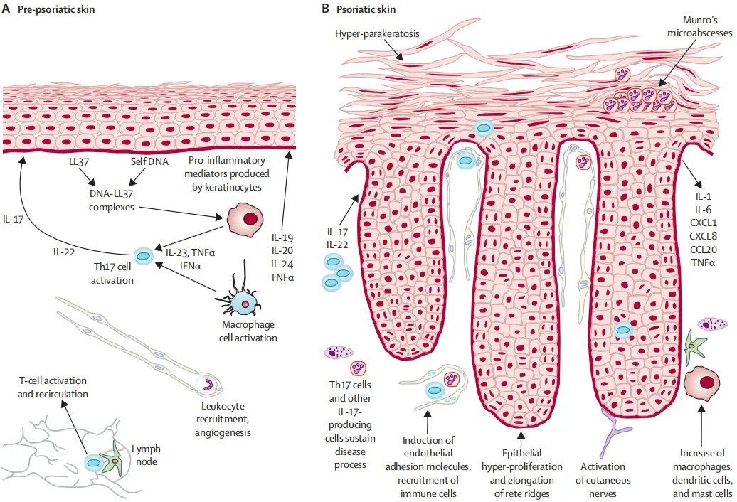 自免和炎症疾病药物开发，离不开这些小鼠