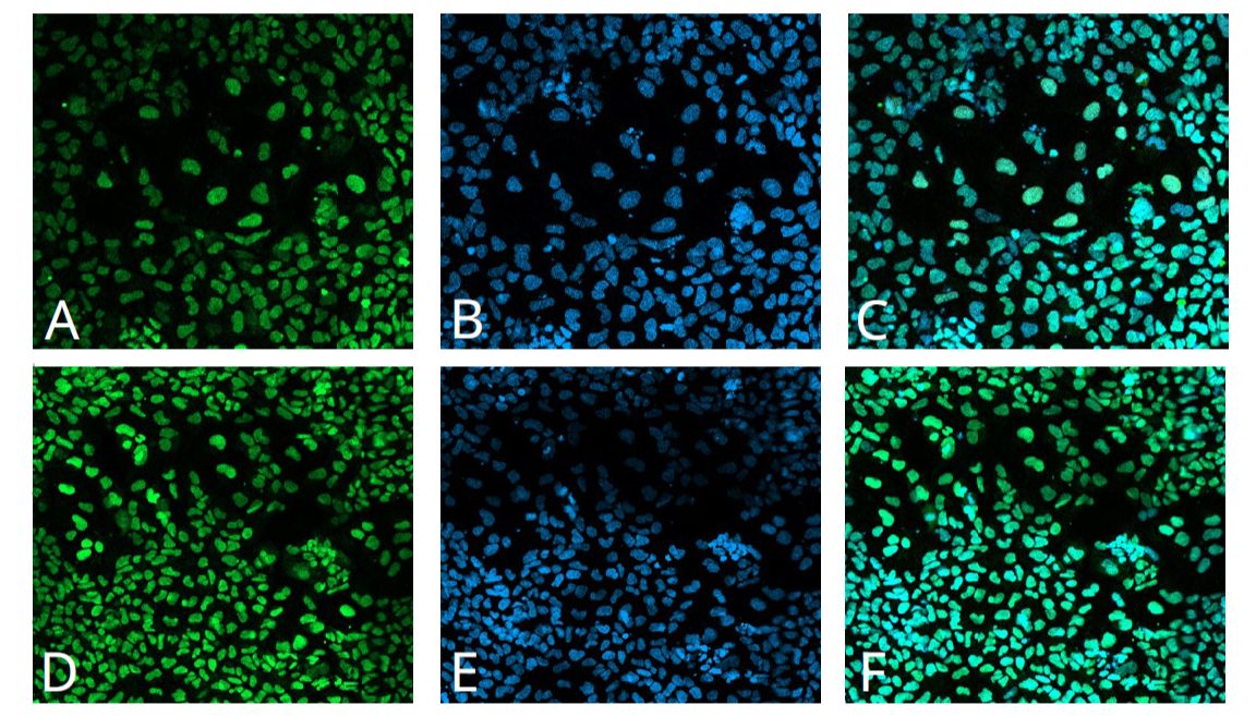 Qkine细胞因子：iPSC向三胚层分化系列--内胚层_曼博生物代理