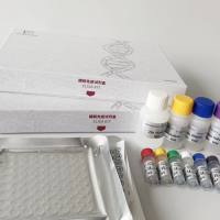 皮诺卡菌(Nocardia farcinica)探针法荧光定量PCR试剂盒