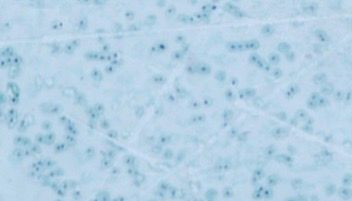 肺炎链球菌简介