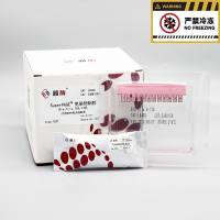 雅酶LK401~LK410 Super-PAGE™ 免染预制胶(含MOPS电泳液)