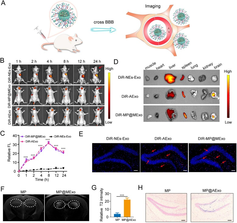 外泌体载药 外泌体载药
