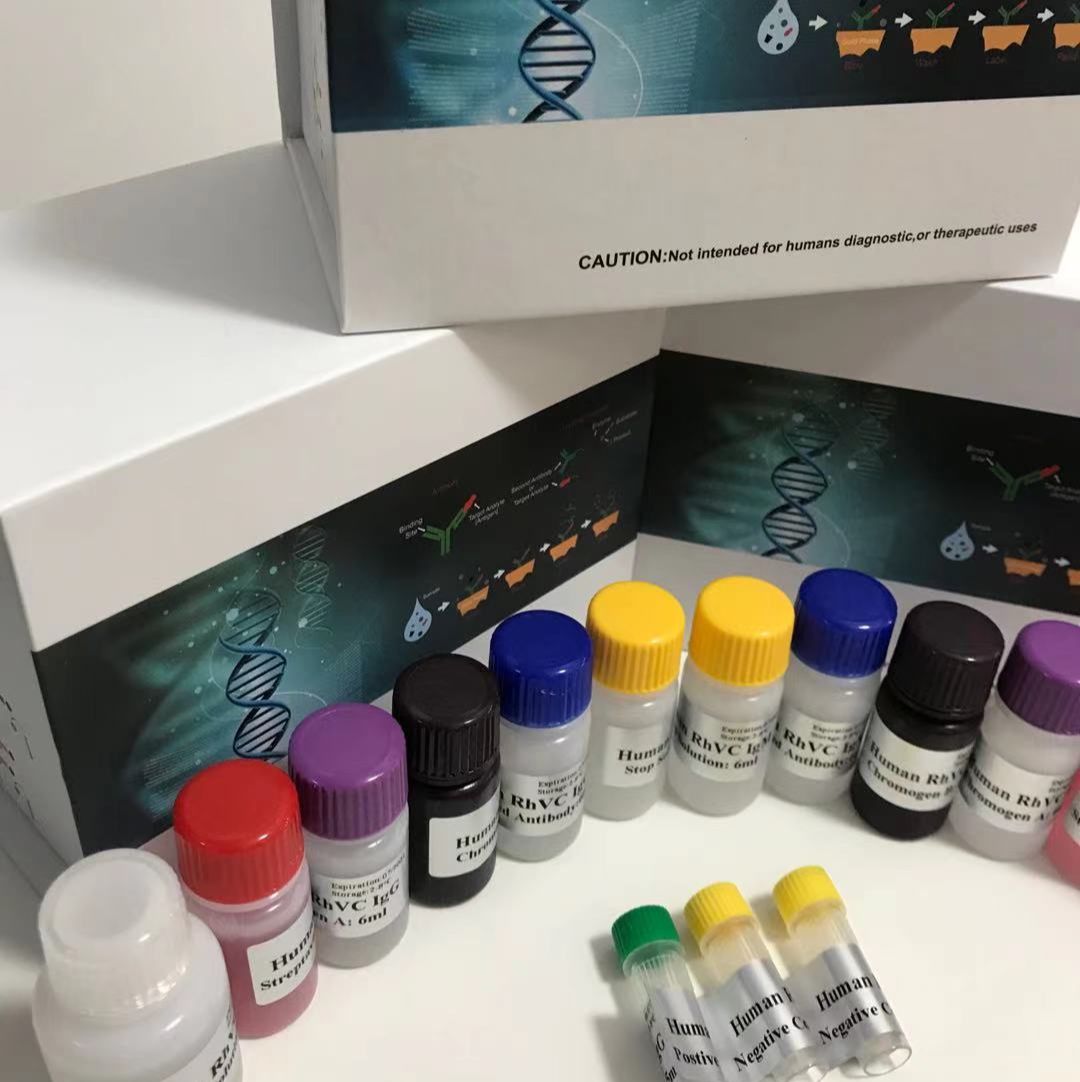 人前列腺小体外泄蛋白（PSEP）ELISA试剂盒