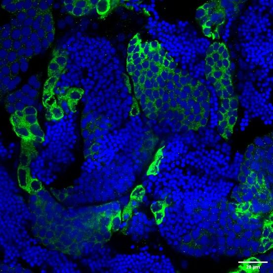 Ddx4 Rabbit Polyclonal Antibody