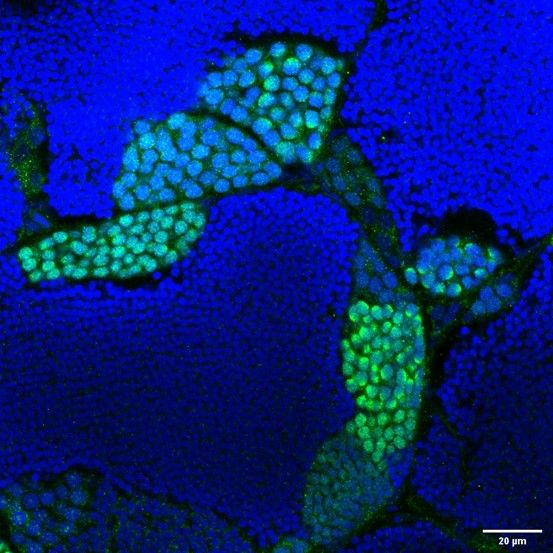 Sycp3 Rabbit Polyclonal Antibody
