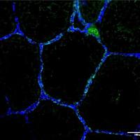 Cdh1 Rabbit Polyclonal Antibody