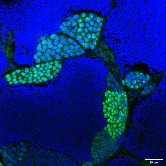 Sycp3 Rabbit Polyclonal Antibo