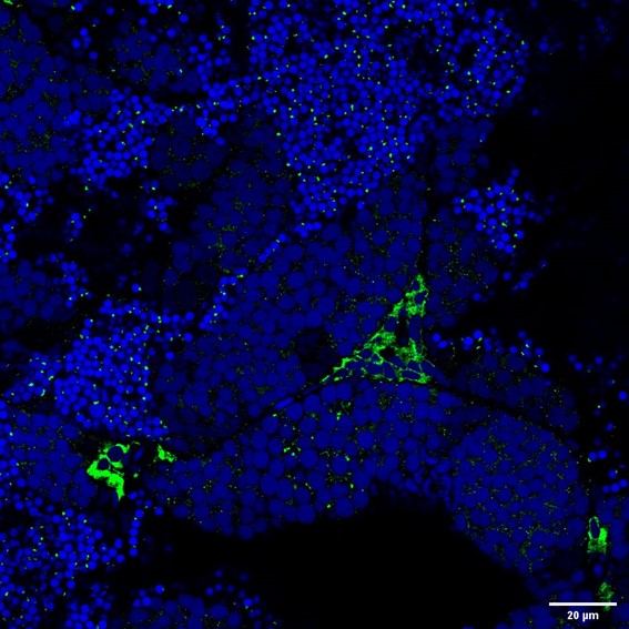 Cyp17a1 Rabbit Polyclonal Anti