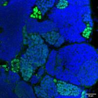 Pcna Rabbit Polyclonal Antibody