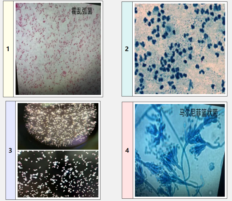 带你了解微生物，什么情况需做微生物检测？