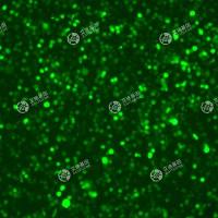 GFP-人骨髓瘤细胞(MM.1S)
